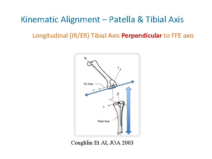 Kinematic Alignment – Patella & Tibial Axis Longitudinal (IR/ER) Tibial Axis Perpendicular to FFE