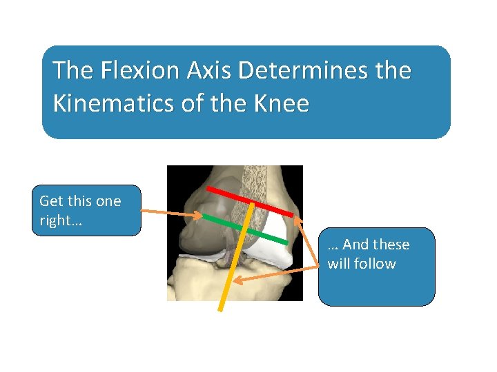 The Flexion Axis Determines the Kinematics of the Knee Get this one right… …
