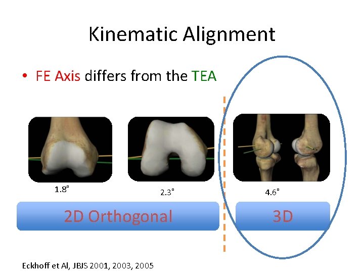 Kinematic Alignment • FE Axis differs from the TEA 1. 8˚ 2. 3˚ 2