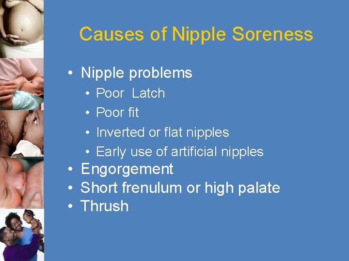 Causes of Nipple Soreness • Nipple problems • • Poor Latch Poor fit Inverted