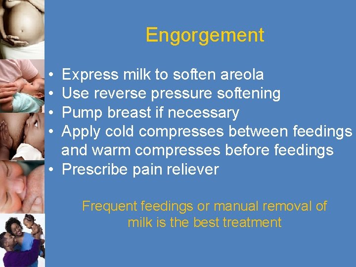 Engorgement • • Express milk to soften areola Use reverse pressure softening Pump breast
