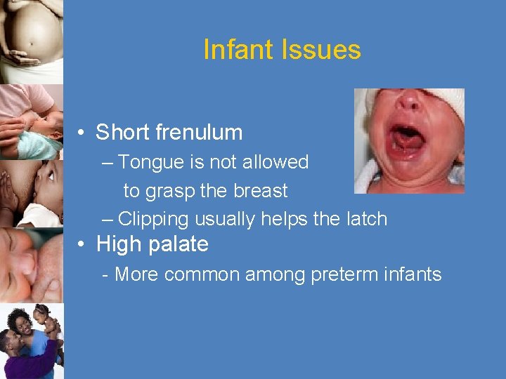 Infant Issues • Short frenulum – Tongue is not allowed to grasp the breast