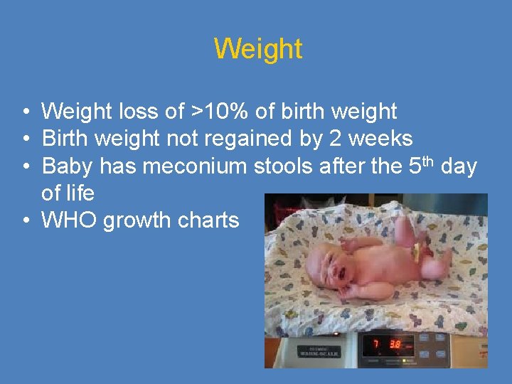 Weight • Weight loss of >10% of birth weight • Birth weight not regained
