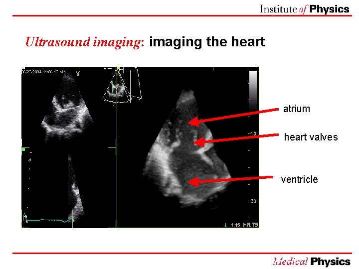 Ultrasound imaging: imaging the heart atrium heart valves ventricle 