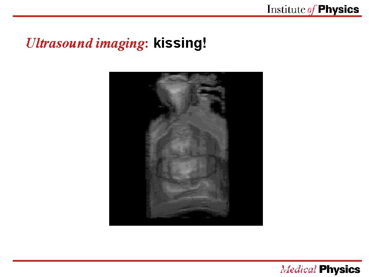 Ultrasound imaging: kissing! 