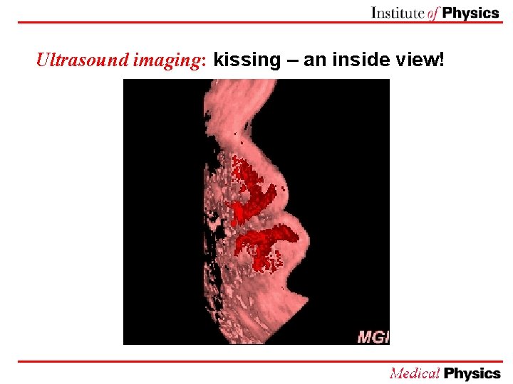Ultrasound imaging: kissing – an inside view! 