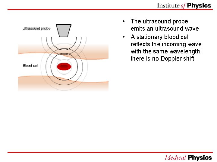  • The ultrasound probe emits an ultrasound wave • A stationary blood cell