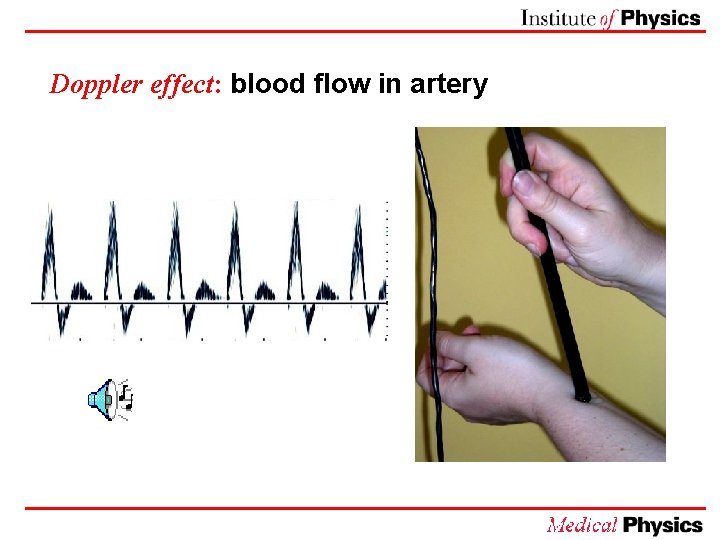 Doppler effect: blood flow in artery 