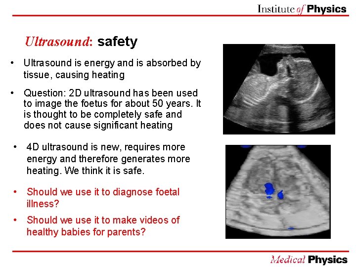 Ultrasound: safety • Ultrasound is energy and is absorbed by tissue, causing heating •