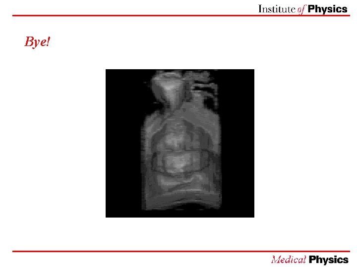 Medical uses of ultrasound Bats Bats navigate using