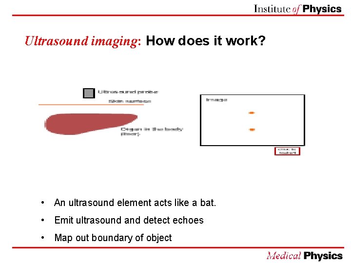 Ultrasound imaging: How does it work? • An ultrasound element acts like a bat.