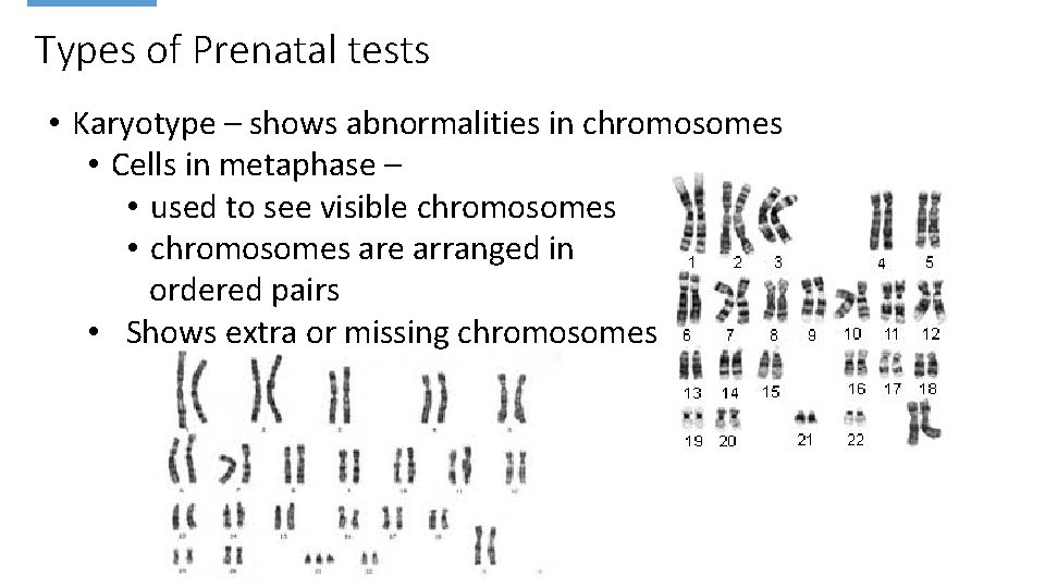 Types of Prenatal tests • Karyotype – shows abnormalities in chromosomes • Cells in
