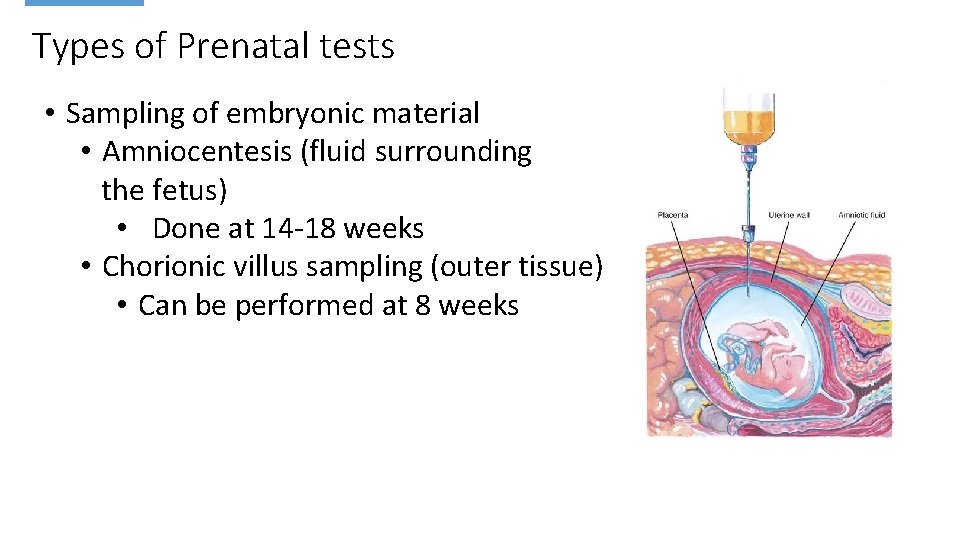 Types of Prenatal tests • Sampling of embryonic material • Amniocentesis (fluid surrounding the