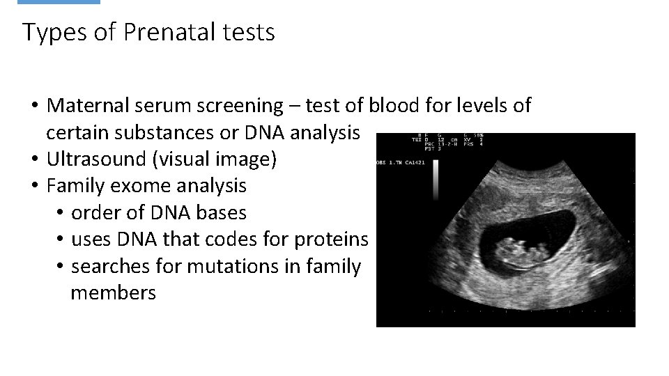 Types of Prenatal tests • Maternal serum screening – test of blood for levels