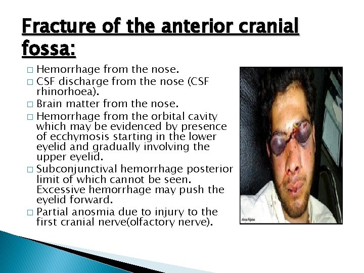 Fracture of the anterior cranial fossa: Hemorrhage from the nose. � CSF discharge from