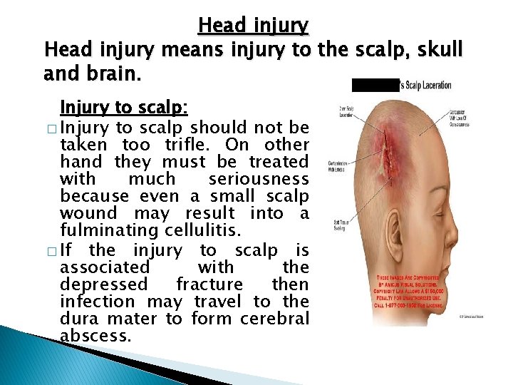 Head injury means injury to the scalp, skull and brain. Injury to scalp: �