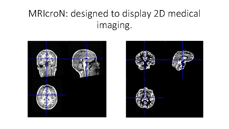 MRIcro. N: designed to display 2 D medical imaging. 