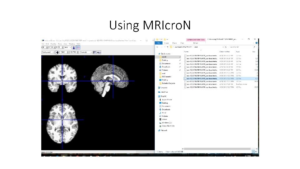 Using MRIcro. N 