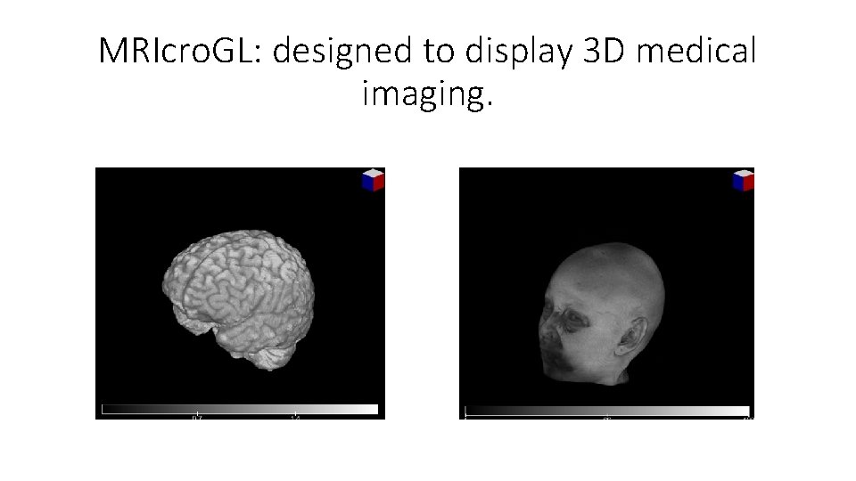 MRIcro. GL: designed to display 3 D medical imaging. 