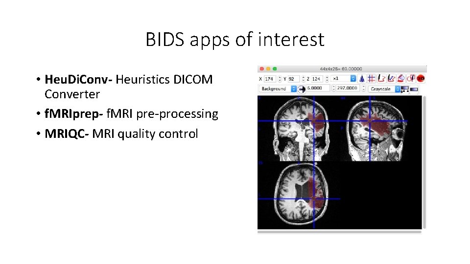 BIDS apps of interest • Heu. Di. Conv- Heuristics DICOM Converter • f. MRIprep-