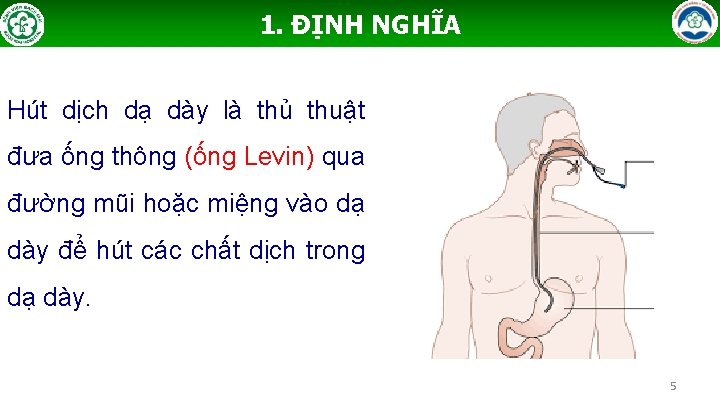 1. ĐỊNH NGHĨA Hút dịch dạ dày là thủ thuật đưa ống thông (ống