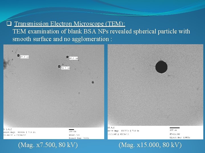 q Transmission Electron Microscope (TEM): TEM examination of blank BSA NPs revealed spherical particle