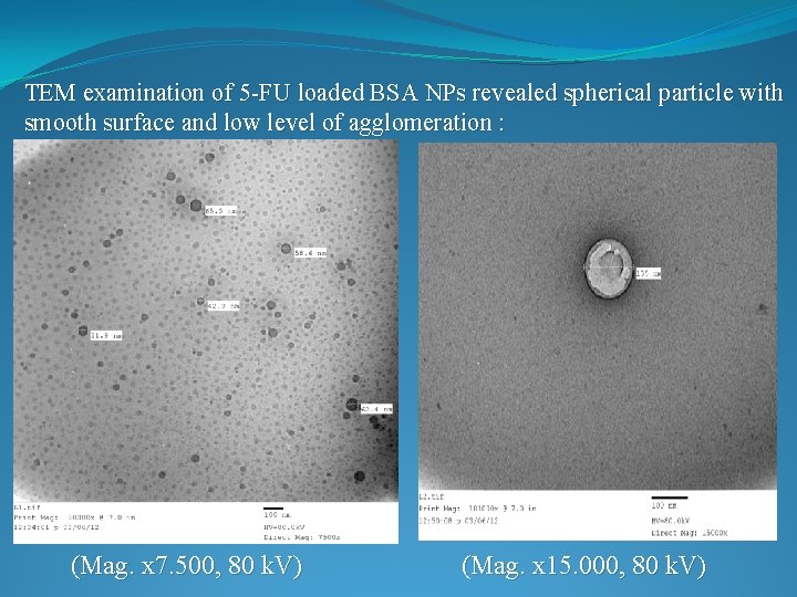 TEM examination of 5 -FU loaded BSA NPs revealed spherical particle with smooth surface