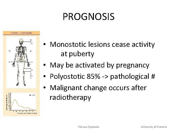 PROGNOSIS • Monostotic lesions cease activity at puberty • May be activated by pregnancy