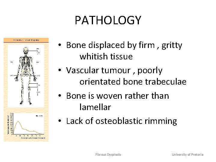 PATHOLOGY • Bone displaced by firm , gritty whitish tissue • Vascular tumour ,