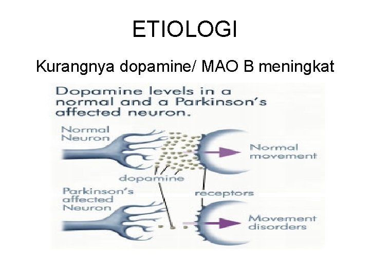 ETIOLOGI Kurangnya dopamine/ MAO B meningkat 