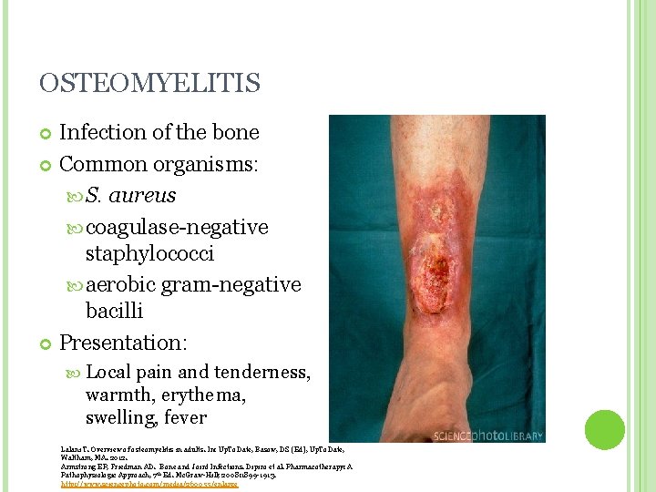 OSTEOMYELITIS Infection of the bone Common organisms: S. aureus coagulase-negative staphylococci aerobic gram-negative bacilli