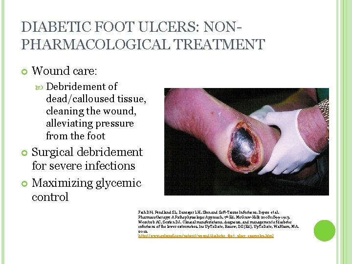 DIABETIC FOOT ULCERS: NONPHARMACOLOGICAL TREATMENT Wound care: Debridement of dead/calloused tissue, cleaning the wound,