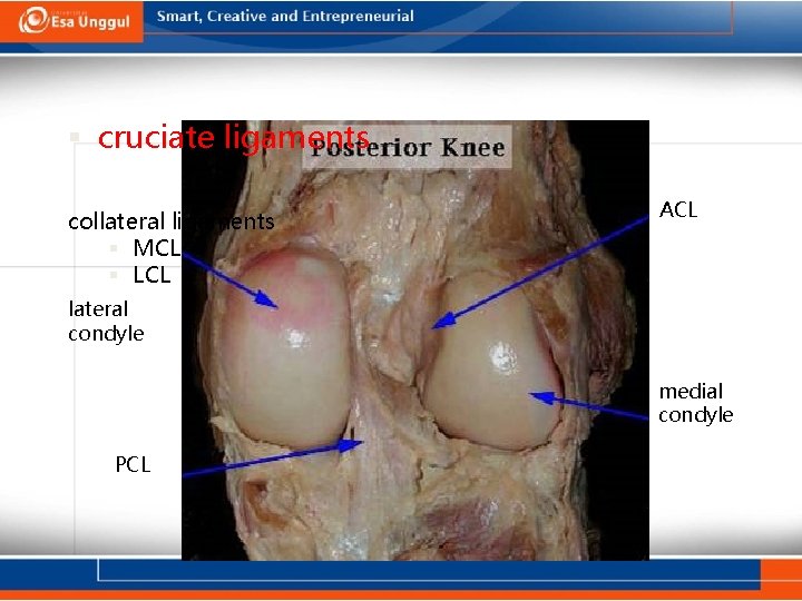  cruciate ligaments collateral ligaments MCL LCL ACL lateral condyle medial condyle PCL 