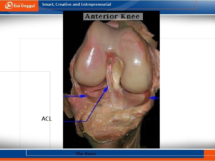 ACL The Knee 