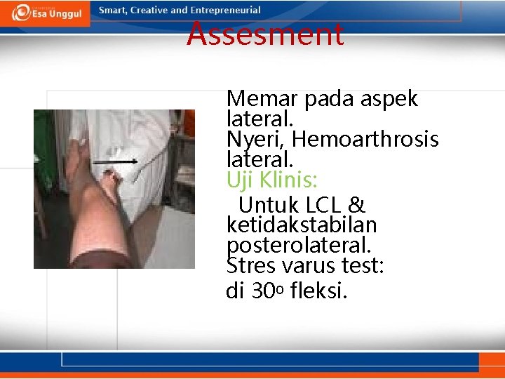 Assesment Memar pada aspek lateral. Nyeri, Hemoarthrosis lateral. Uji Klinis: Untuk LCL & ketidakstabilan