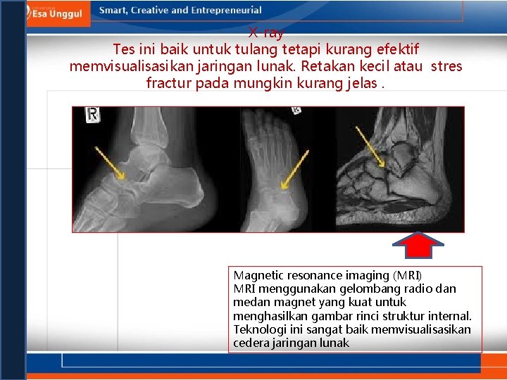 X-ray Tes ini baik untuk tulang tetapi kurang efektif memvisualisasikan jaringan lunak. Retakan kecil