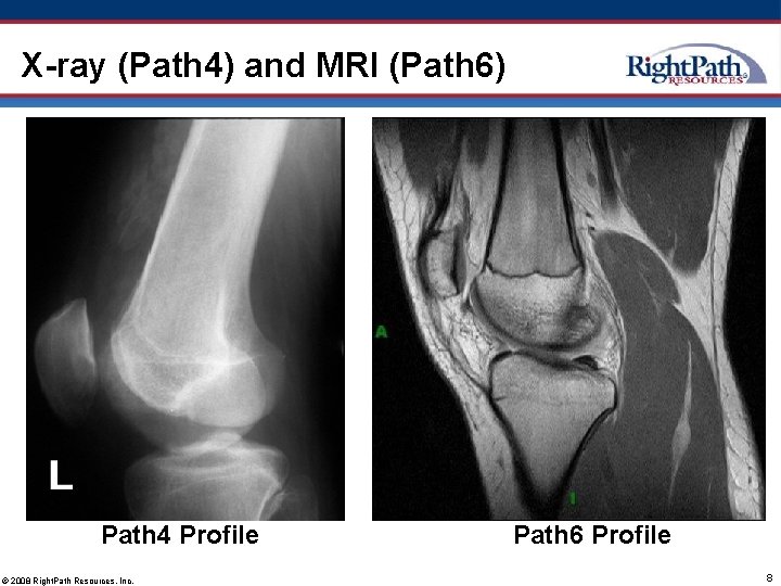 X-ray (Path 4) and MRI (Path 6) Path 4 Profile © 2008 Right. Path