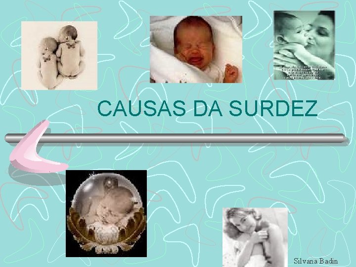 CAUSAS DA SURDEZ Silvana Badin 