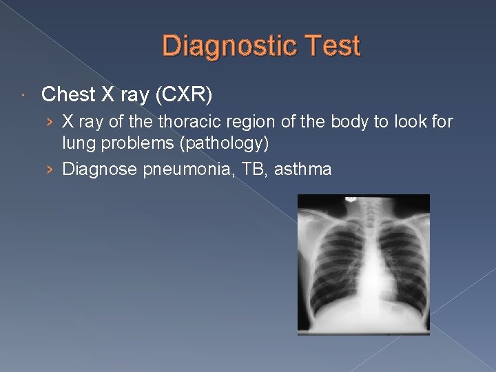 Diagnostic Test Chest X ray (CXR) › X ray of the thoracic region of