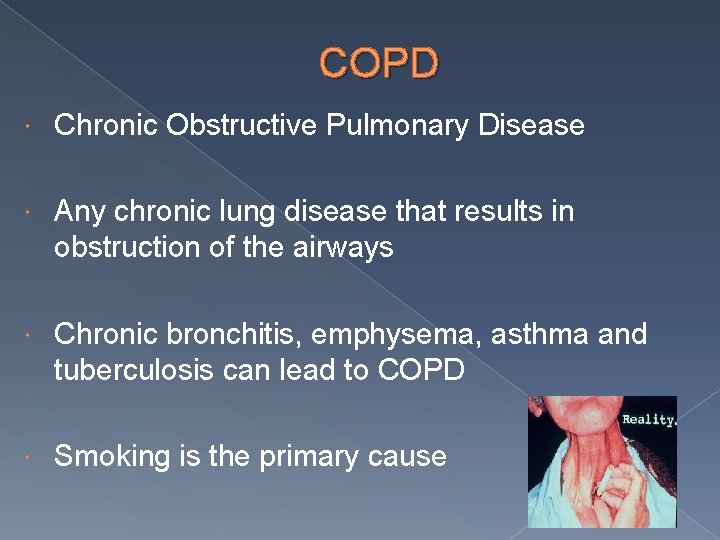 COPD Chronic Obstructive Pulmonary Disease Any chronic lung disease that results in obstruction of