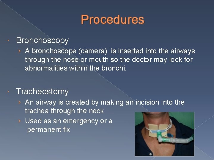 Procedures Bronchoscopy › A bronchoscope (camera) is inserted into the airways through the nose