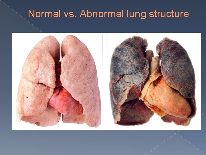 Normal vs. Abnormal lung structure 