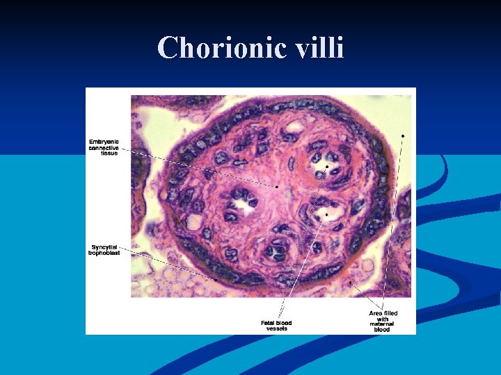 Chorionic villi 