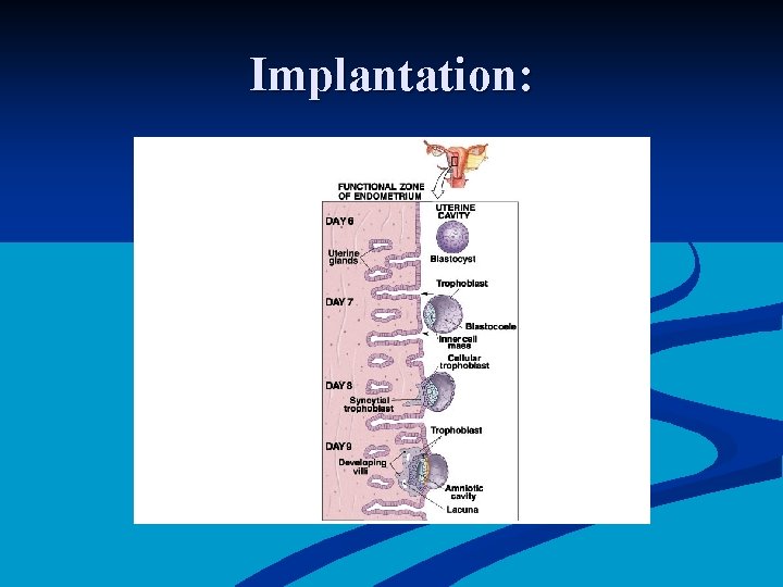 Implantation: 