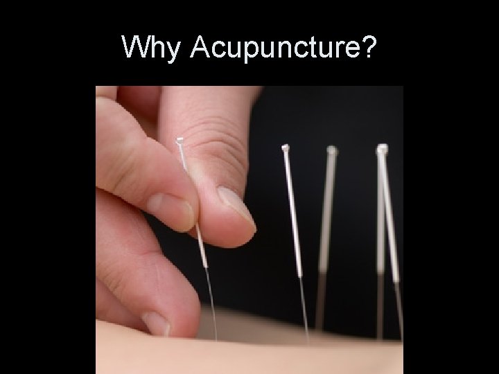 Why Acupuncture? 