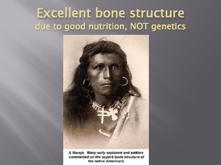Excellent bone structure due to good nutrition, NOT genetics 