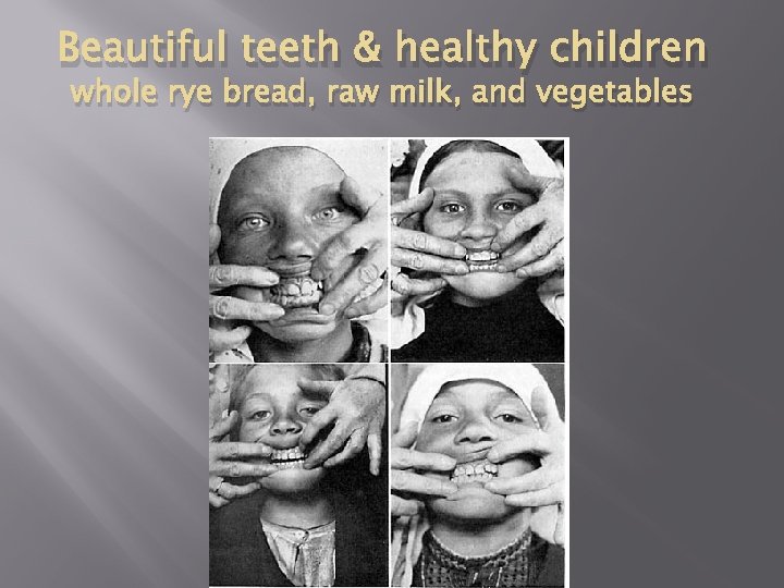 Beautiful teeth & healthy children whole rye bread, raw milk, and vegetables 