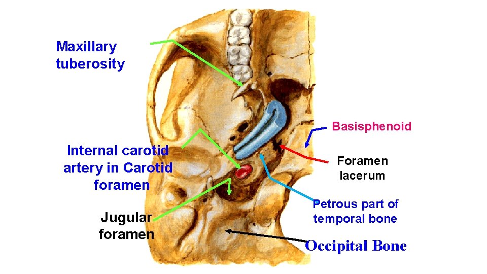 Maxillary tuberosity Basisphenoid Internal carotid artery in Carotid foramen Jugular foramen Foramen lacerum Petrous