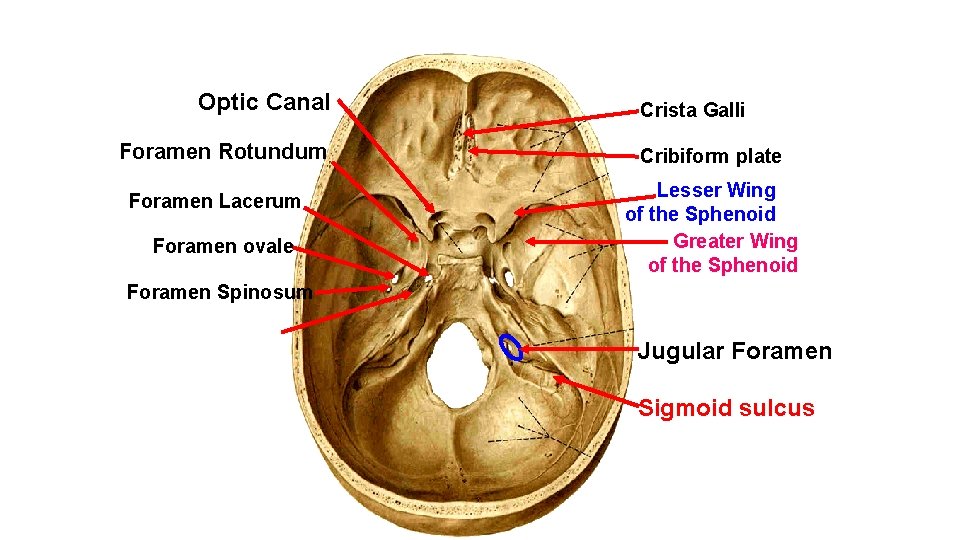 Optic Canal Foramen Rotundum Foramen Lacerum Foramen ovale Crista Galli Cribiform plate Lesser Wing