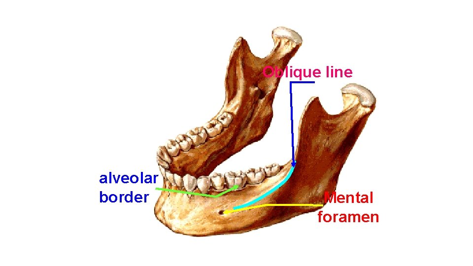 Oblique line alveolar border Mental foramen 